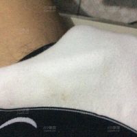 随拍