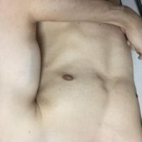 00